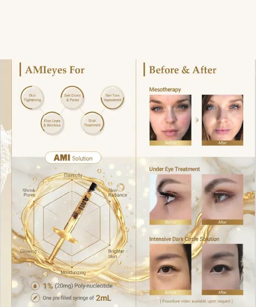 AMI Eyes FILLERS